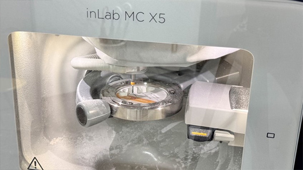 ミリングマシンで補綴物を加工