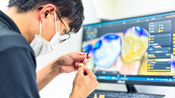 焼成後のジルコニアにグレーズやステインを表層に施し色調や質感を調整